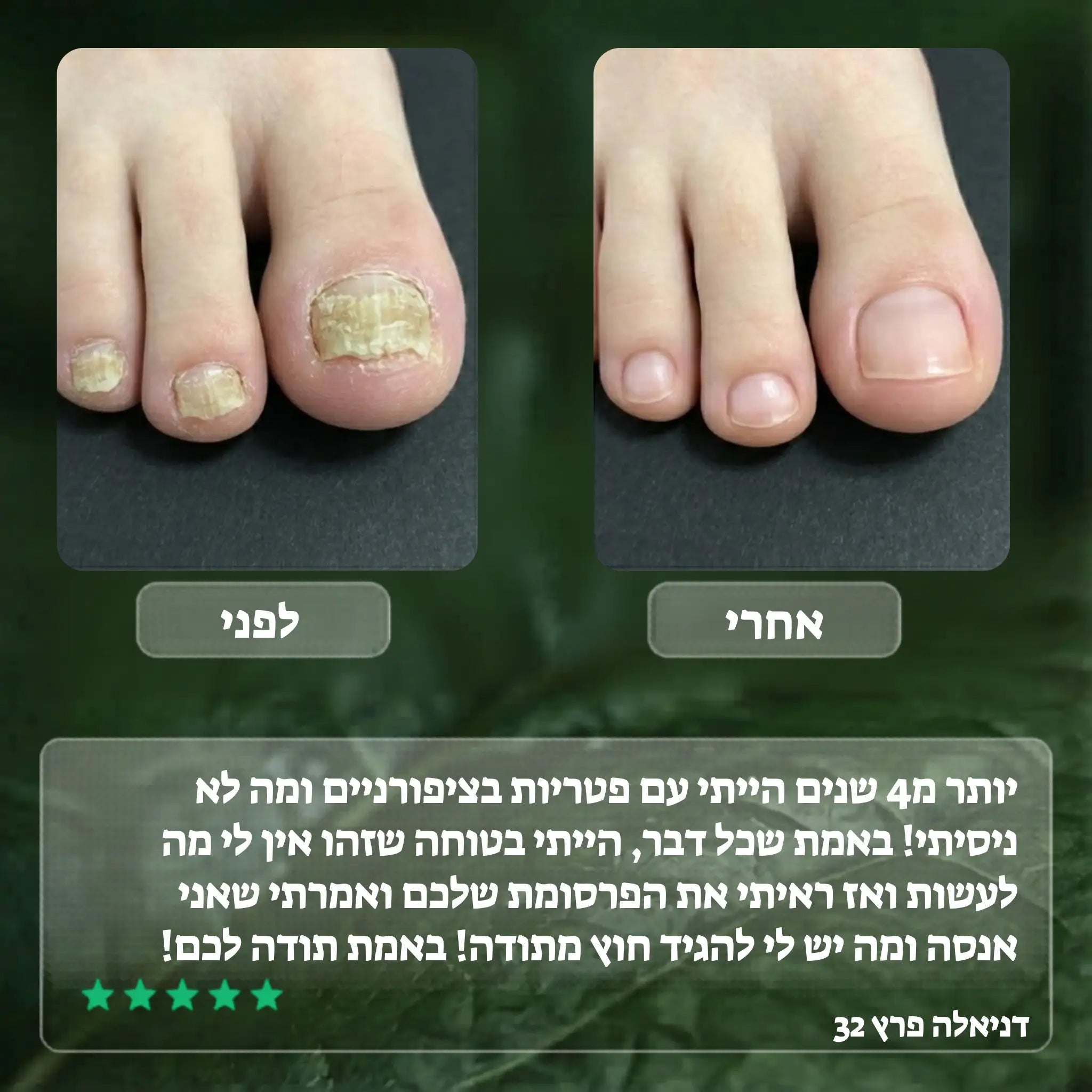 Elisee Nail Fungus Serum