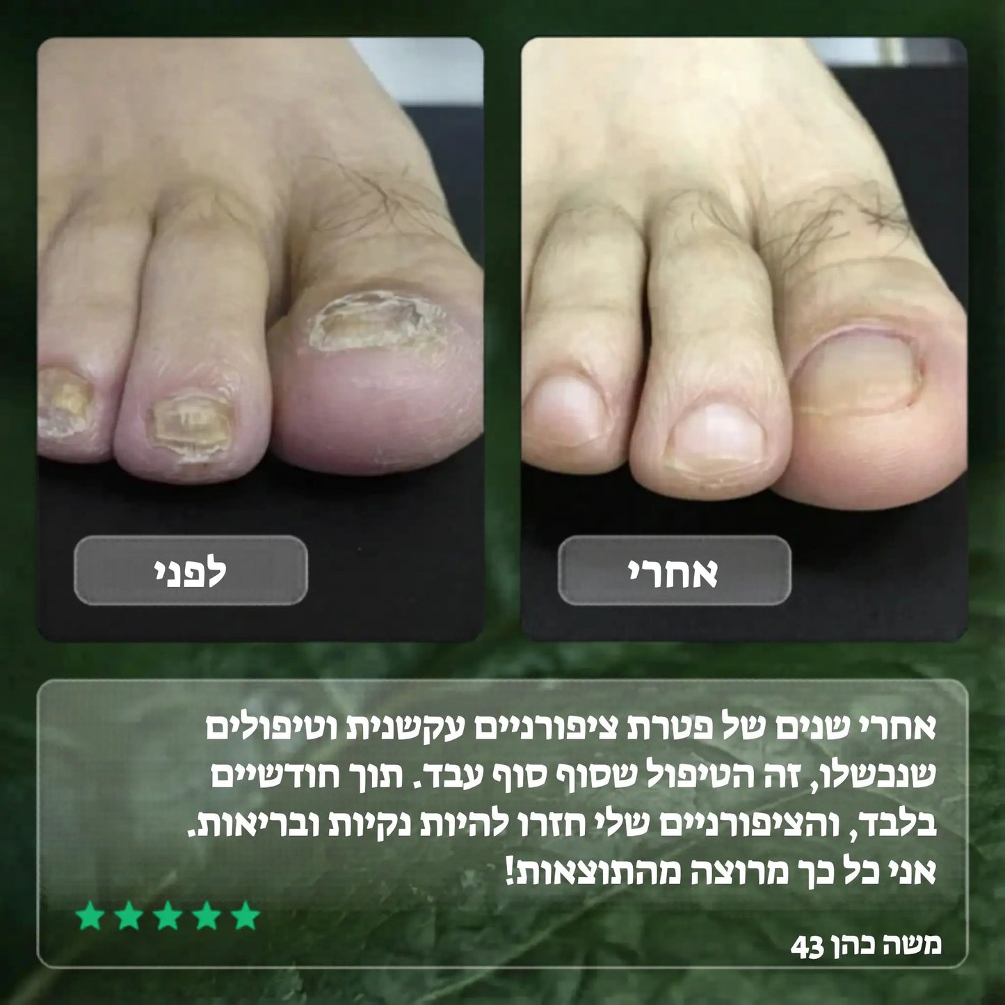 Elisee Nail Fungus Serum