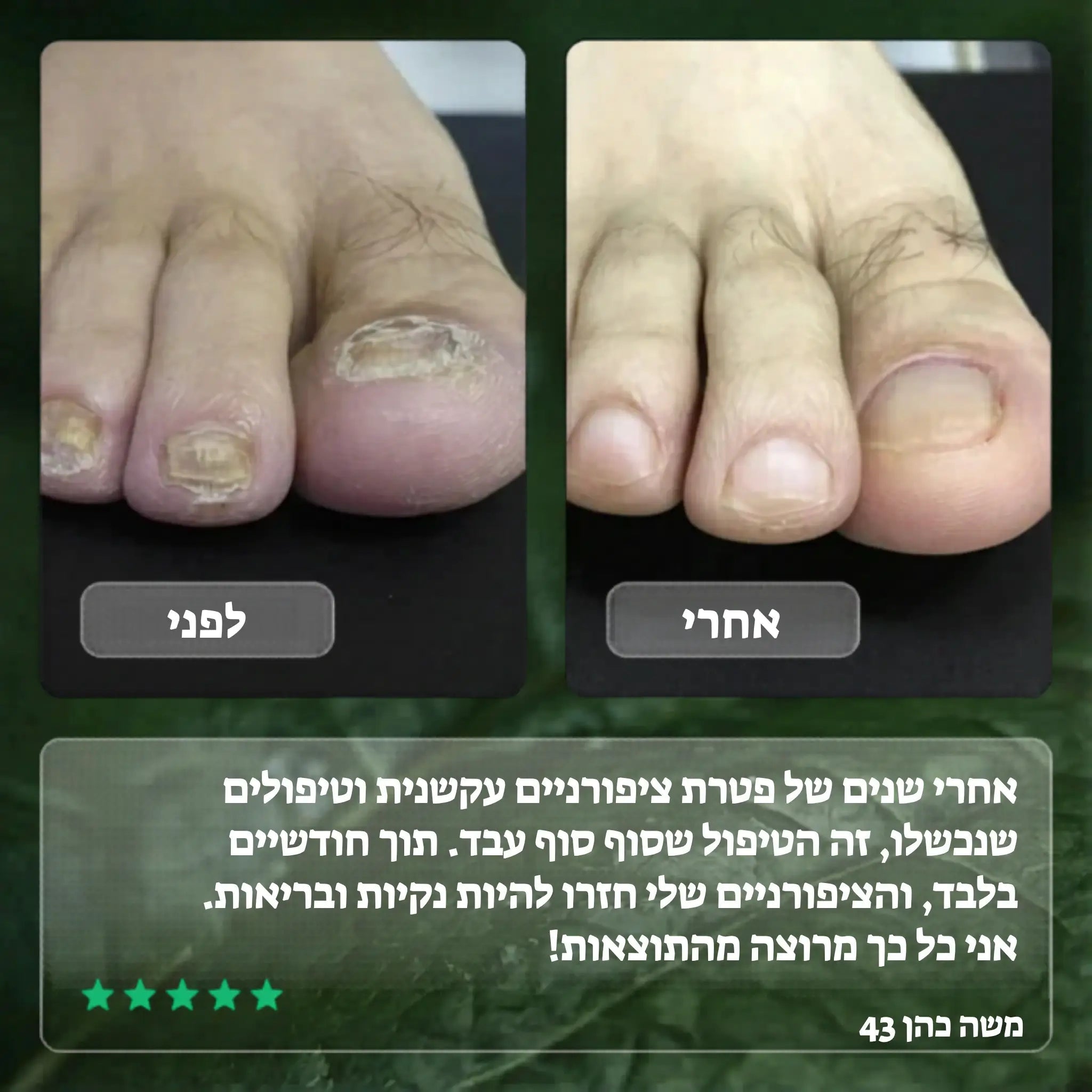 Elisee Nail Fungus Serum