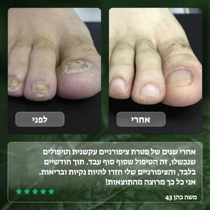 Elisee Nail Fungus Serum