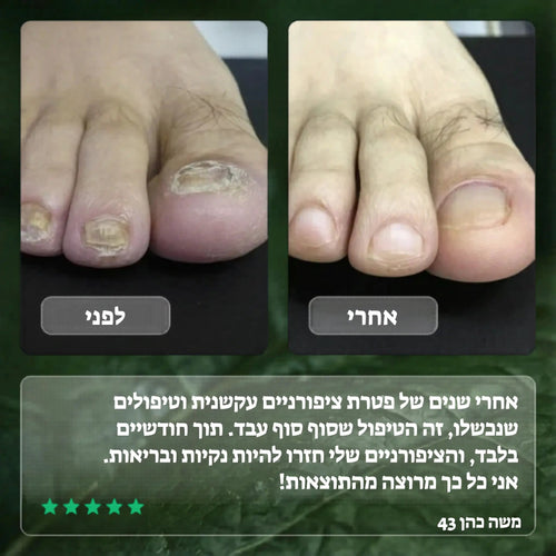 Elisee Nail Fungus Serum