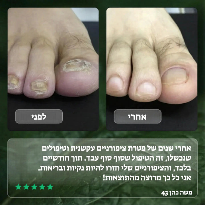 Elisee Nail Fungus Serum